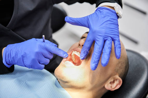 Best Emergency Treatment for Toothache in Bessemer, MI